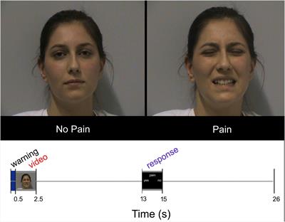 Pain Mirrors: Neural Correlates of Observing Self or Others’ Facial Expressions of Pain